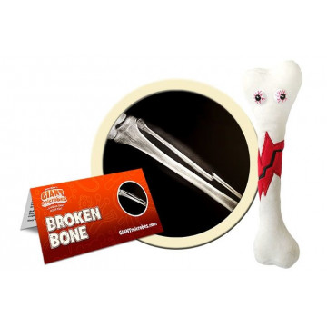 giantmicrobes broken bone